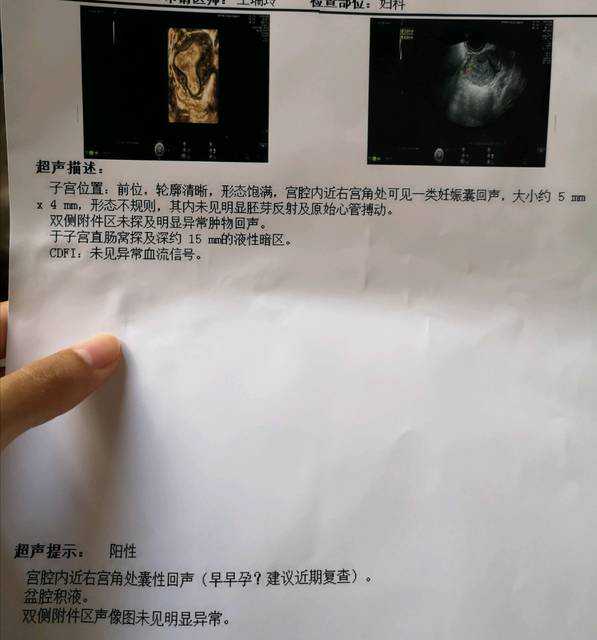 重庆生殖助孕医院，重庆生殖专科医院有哪些好