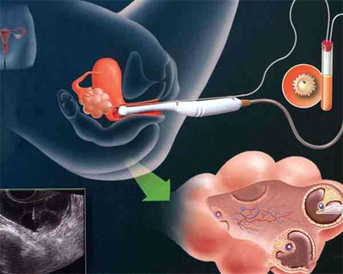 代孕找哪里,国内私立医院三代试管婴儿私立医院三代试管婴儿安全吗！做好计