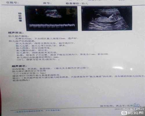 广州代孕案件：为何会发生宫外孕