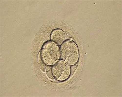 多囊卵巢会卵巢早衰吗？