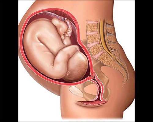 如何预防女性卵巢性不孕
