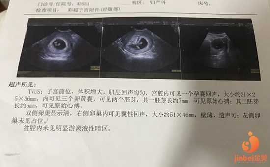 重庆做供卵移植的医院,【重庆供卵的医院地址】备孕两年，流产过，只剩下一